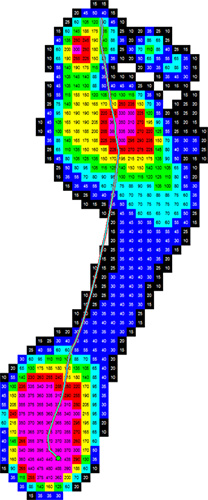 barefoot plantar pressure map