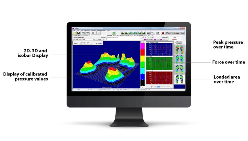 pedar software displaying pressure maps and pressure, force and contact-area curves